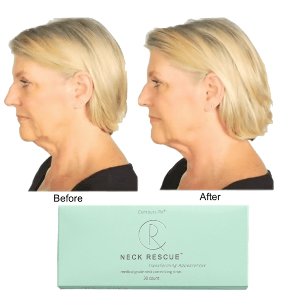 MorningSave 120Pack Contours Rx NECK RESCUE NonSurgical Correcting