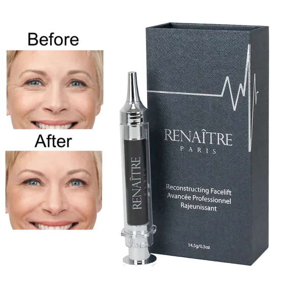 Renaître Reconstructing Facelift