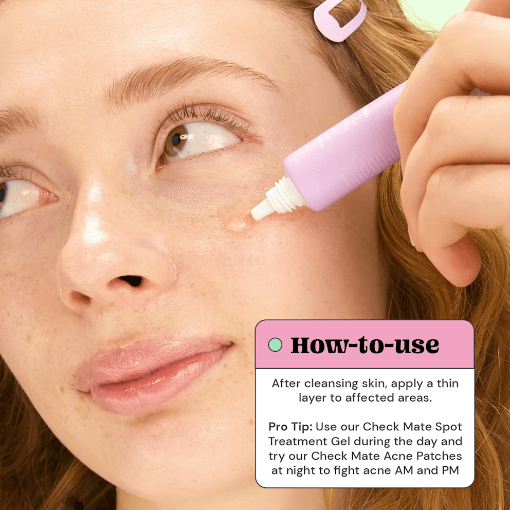 Check Mate Acne Spot Treatment Gel fights blemishes with a soothing touch.