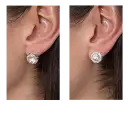 Before and After