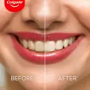 Visibly whitens teeth in just 1 week