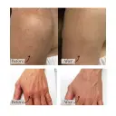 Fade age spots and sun damage