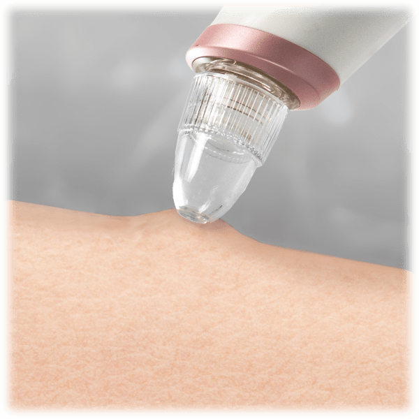 Meh Brookstone Pore Suction Vacuum Cleanser