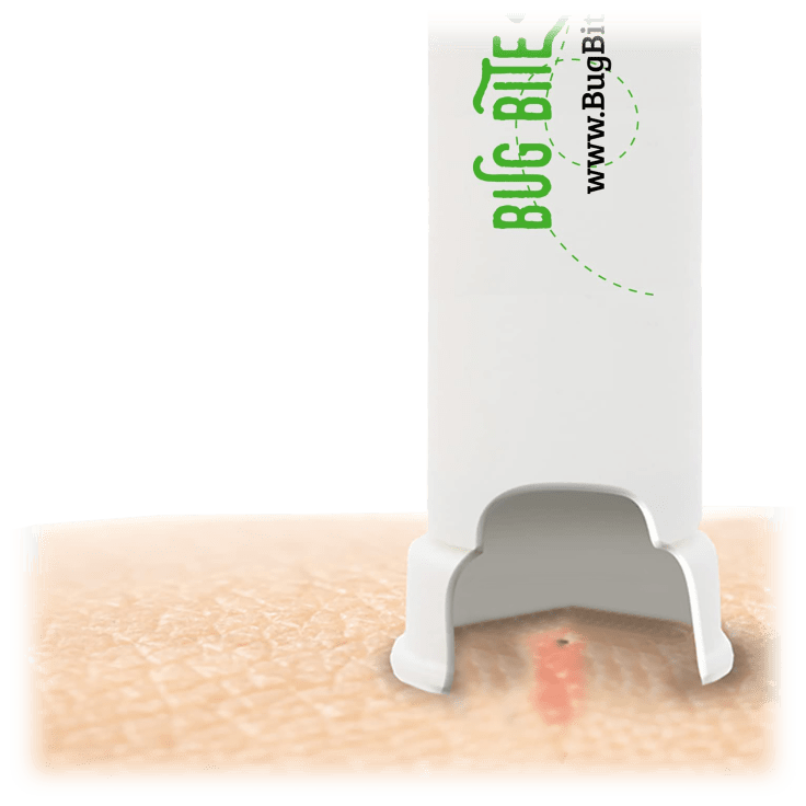 SideDeal 2Pack Bug Bite Thing Bug Bite Thing Suction Tool, Poison