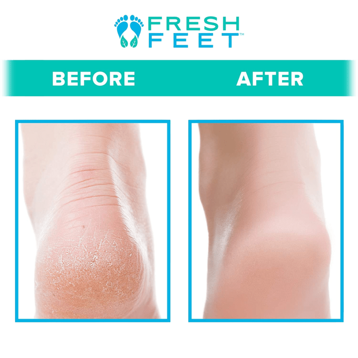 MorningSave Fresh Feet Foot Scrubber Deluxe with Pumice Stone