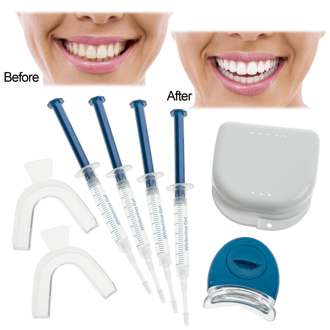 How To Use Teeth Whitening Kit