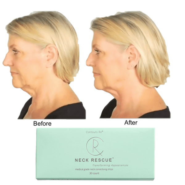60-Pack Contours Rx NECK RESCUE Non-Surgical Correcting Strips