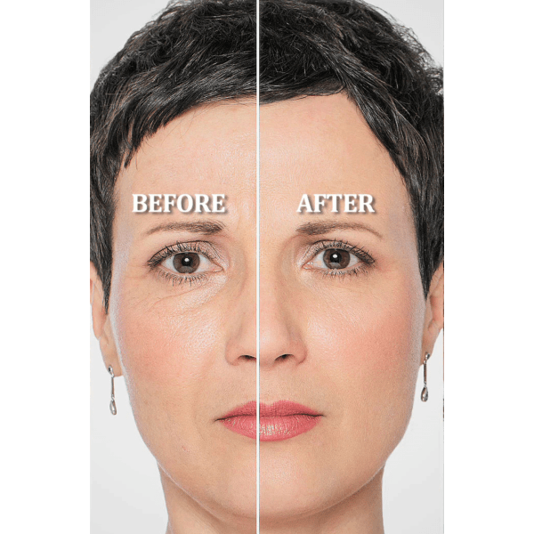 MorningSave: Dynamic Innovation 90-Second Eye Lift