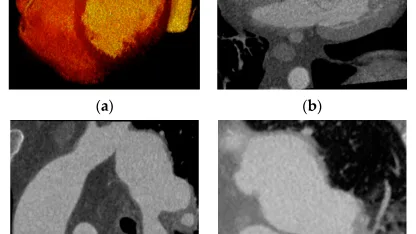 PSA-Oral B Recycling Program