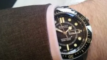 What's on your wrist?