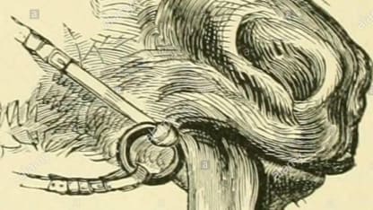 "Standard" time can get bent