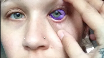 This is a case of too much purple.