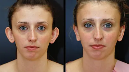 Meh, get out of my ears!