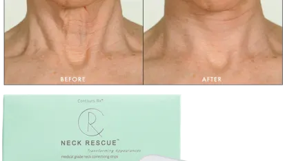Contours Rx NECK RESCUE Non-Surgical Correcting Strips (30 Pack)