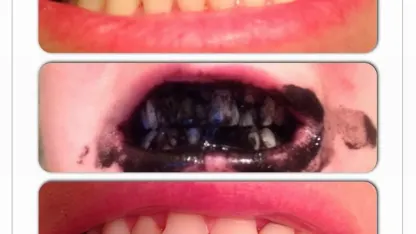 Do you whiten your teeth?