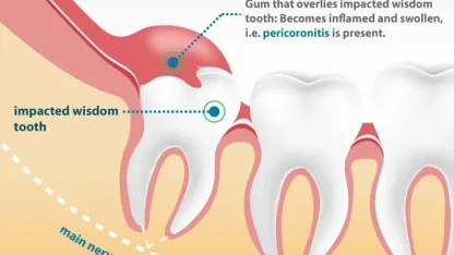Do you still have your wisdom teeth?
