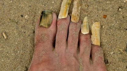 How often do you trim your fingernails/toenails?
