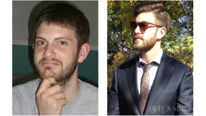 Can you grow a beard?