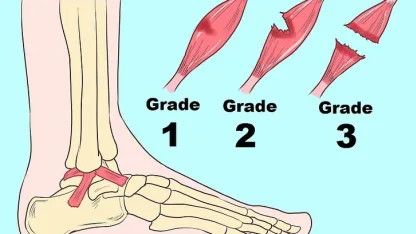 You tweak something while working out. Think something like rolling an ankle: not severe, but not nothing.