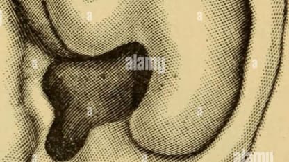 In Which Speculation Occurs