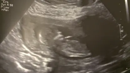 Parents, What's Your Baby Registry Must Have?