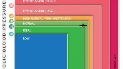 My numbers are 121/79 76