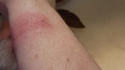 I'm NEVER allergic! ...'til now