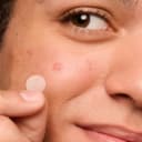 144-Pack: Mighty Patch Acne and Pimple Patches