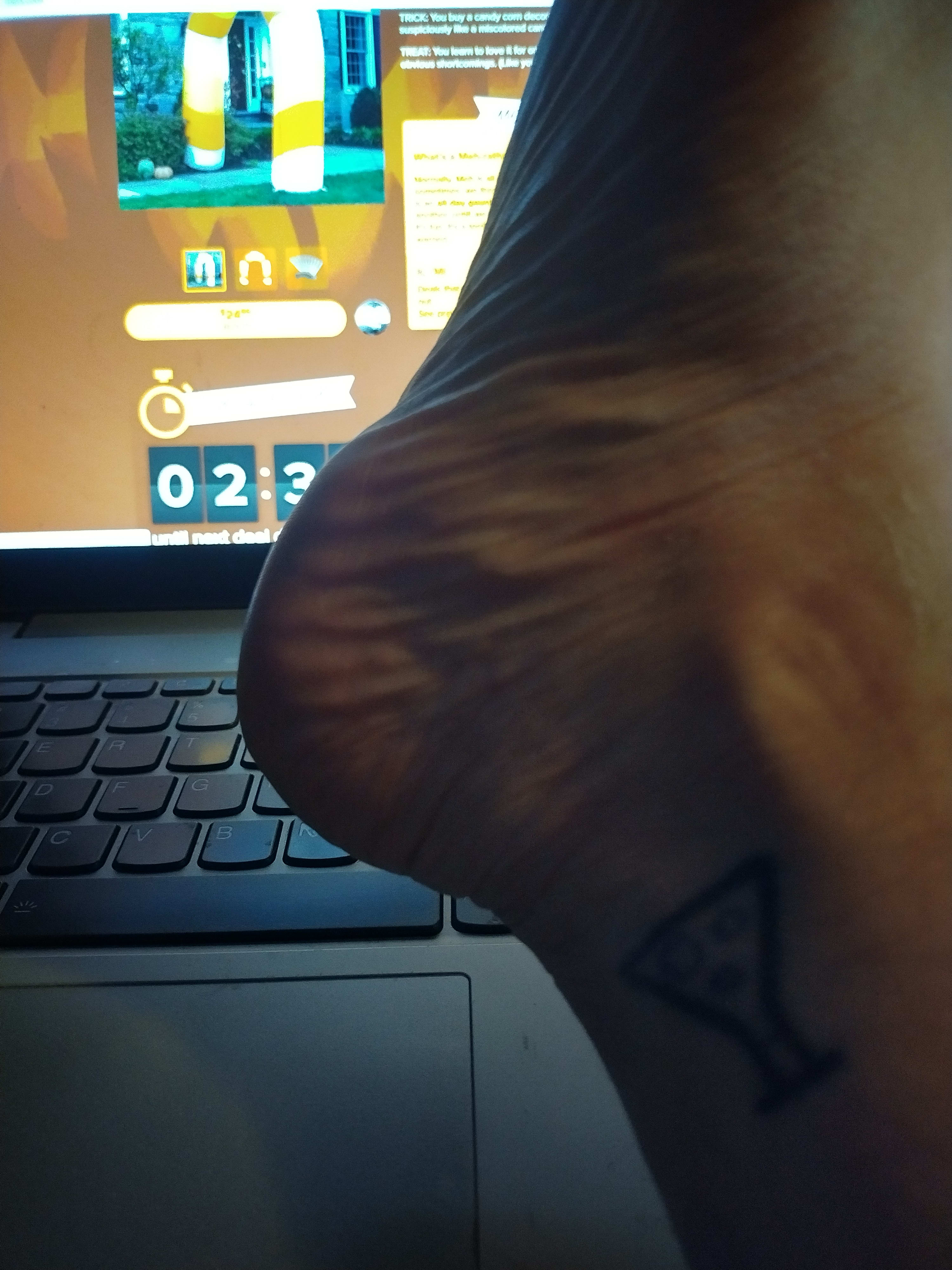 enter image description here