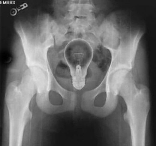 NOT-THE-BRIGHTEST-IDEA