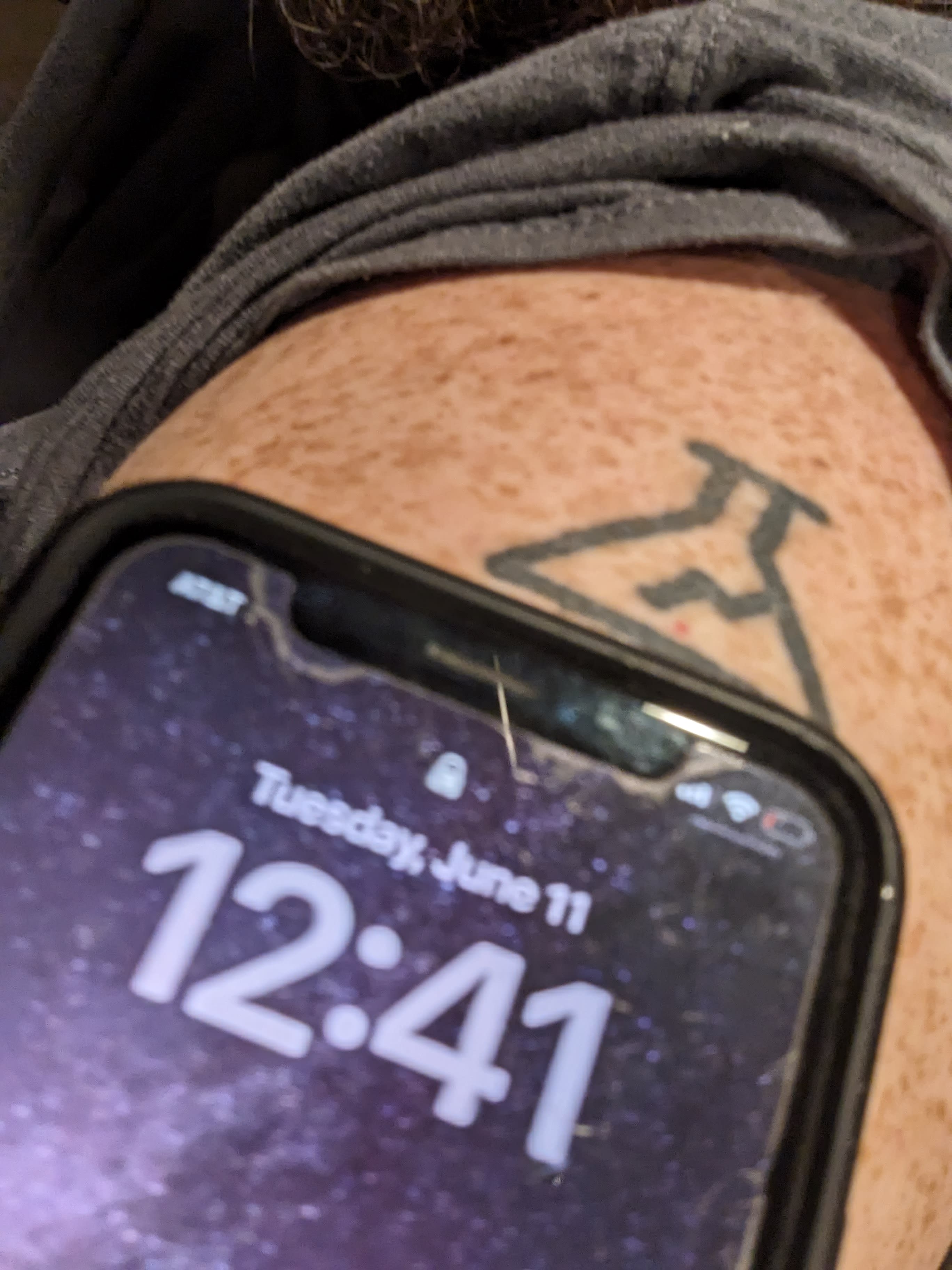 subcutaneous junk coupon