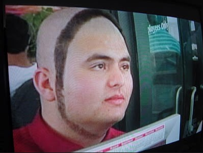 ring around the face hair